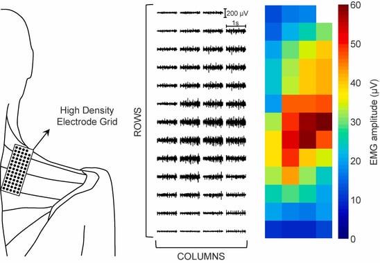 High-Density EMG Heatmap