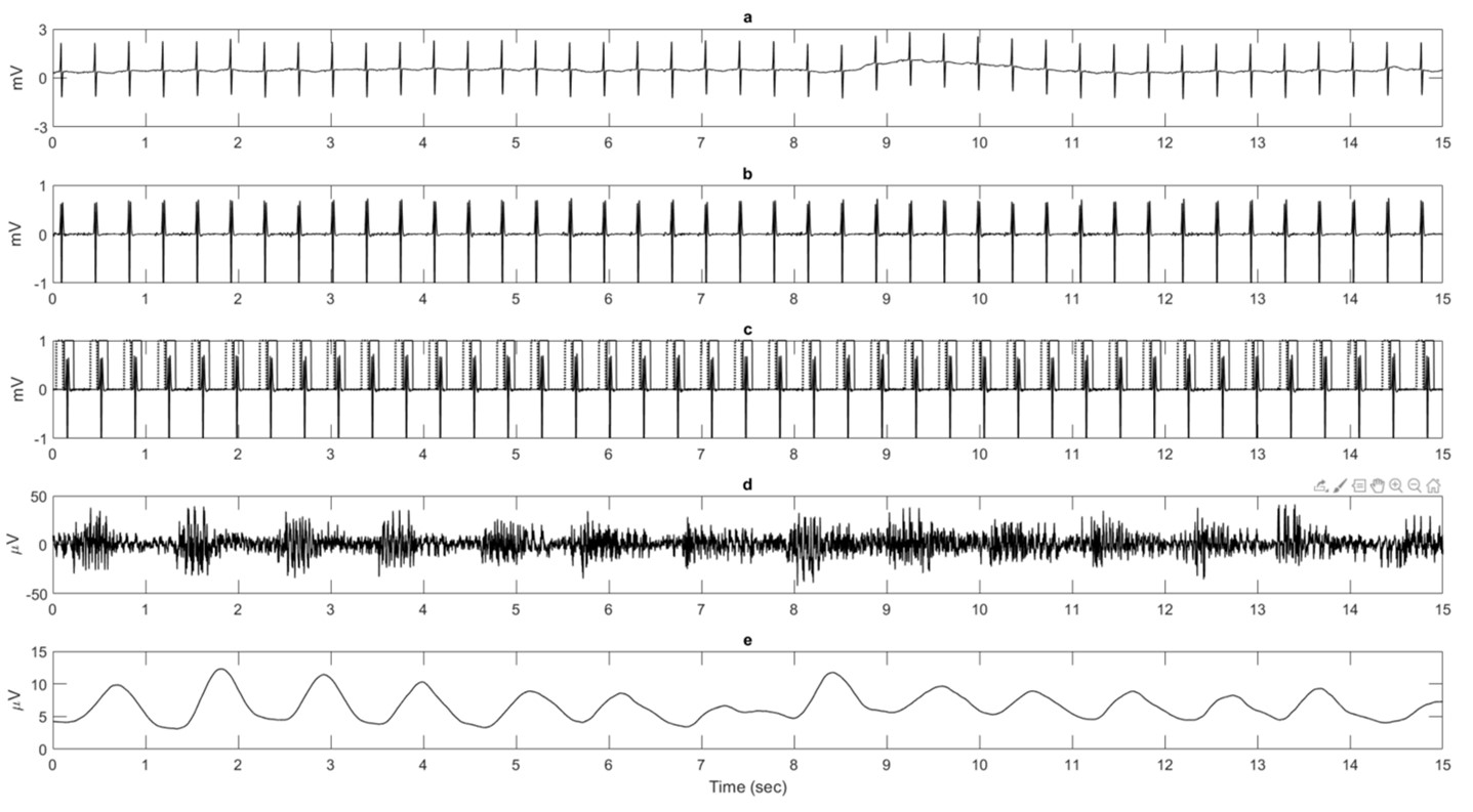 diaphragm EMG analysis - Case study TMSi